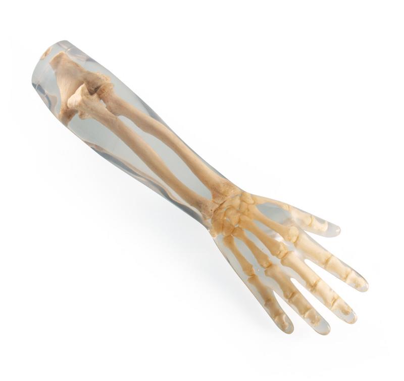 72202_1.jpg X-Ray Phantom Lower Arm, opaque - Görsel 1