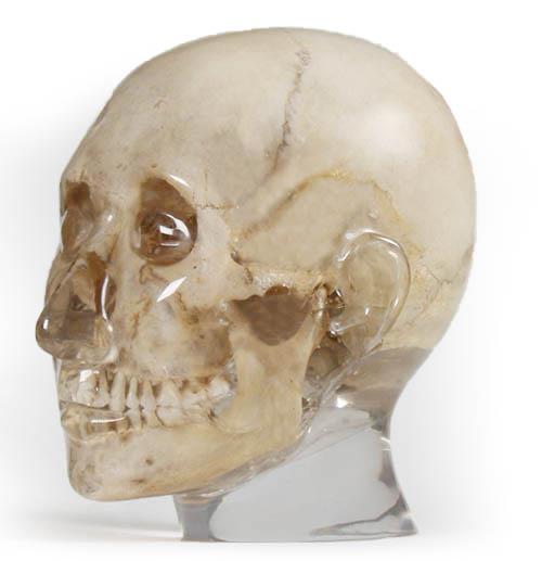 73201_1.jpg X-Ray Phantom Foot, opaque - Görsel 1