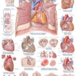 Chart Lower Limb, 70x100cm