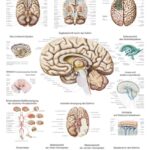 Meningioma